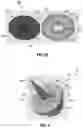 Fig. 04 - Temperature detection for vaporization devices