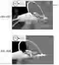 Fig. 44 - HANDLE FOR PARANASAL SINUS ACCESS DEVICE