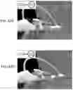 Fig. 45 - HANDLE FOR PARANASAL SINUS ACCESS DEVICE