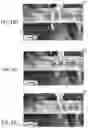 Fig. 49 - HANDLE FOR PARANASAL SINUS ACCESS DEVICE