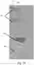 Fig. 09 - Medical visualisation device
