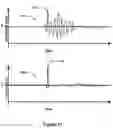 Fig. 14 - Intelligent Inflatable Cuff for Arm-Based Blood Pressure Measurement