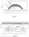 Fig. 02 - Vital sign sensor and method for manufacturing a vital sign sensor