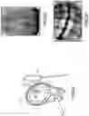 Fig. 09 - Movable and static collimators and x-ray source arrangements for intraoral tomosynthesis