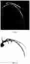 Fig. 07 - Method and apparatus for correcting blood flow velocity on the basis of interval time between angiogram images