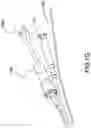 Fig. 06 - INTRACARDIAC DELIVERY CATHETER AND METHOD OF USE