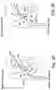 Fig. 08 - INTRACARDIAC DELIVERY CATHETER AND METHOD OF USE