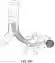 Fig. 49 - LUNG ACCESS DEVICE