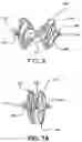 Fig. 07 - SEALING DEVICE AND DELIVERY SYSTEM