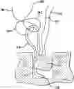 Fig. 01 - Adjustable all-suture anchoring assembly and method