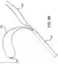 Fig. 09 - Adjustable all-suture anchoring assembly and method