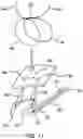 Fig. 10 - Adjustable all-suture anchoring assembly and method