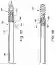 Fig. 10 - EXTRA JOINT STABILIZATION CONSTRUCT