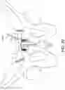 Fig. 13 - EXTRA JOINT STABILIZATION CONSTRUCT