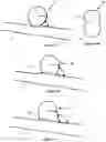 Fig. 02 - Apparatus and Methods for Intravascular Treatment of Aneurysms