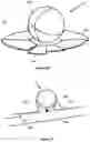 Fig. 09 - Apparatus and Methods for Intravascular Treatment of Aneurysms