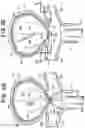 Fig. 07 - INTRASACCULAR FLOW DIVERTER FOR TREATING CEREBRAL ANEURYSMS