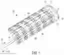 Fig. 02 - INTEGRATED MEDICAL DEVICE CONSTRAINING LUMEN