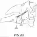 Fig. 132 - VERTEBRAL JOINT IMPLANTS AND DELIVERY TOOLS