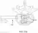 Fig. 143 - VERTEBRAL JOINT IMPLANTS AND DELIVERY TOOLS