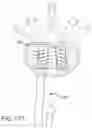 Fig. 144 - VERTEBRAL JOINT IMPLANTS AND DELIVERY TOOLS