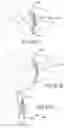 Fig. 52 - VERTEBRAL JOINT IMPLANTS AND DELIVERY TOOLS