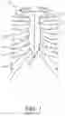Fig. 02 - STERNUM FIXATION DEVICE AND METHOD