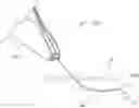 Fig. 01 - Methods and Systems for Preventing Neuroma Formations