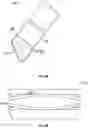 Fig. 07 - ELECTROSURGICAL BLADE ELECTRODE ADDING PRECISION DISSECTION PERFORMANCE AND TACTILE FEEDBACK
