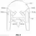 Fig. 13 - SOFT PALATE TREATMENT