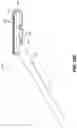 Fig. 16 - SOFT PALATE TREATMENT