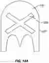 Fig. 19 - SOFT PALATE TREATMENT