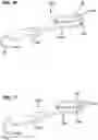 Fig. 22 - SOFT PALATE TREATMENT