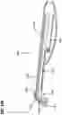 Fig. 32 - SOFT PALATE TREATMENT
