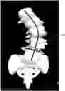 Fig. 01 - Systems and methods for modeling spines and treating spines based on spine models