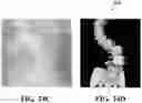 Fig. 35 - Systems and methods for modeling spines and treating spines based on spine models