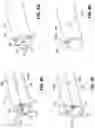 Fig. 07 - Apparatus and methods relating to intravascular positioning of distal end of catheter