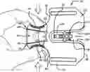 Fig. 01 - Prosthetic heart valve packaging