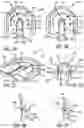 Fig. 04 - Prosthetic heart valve packaging
