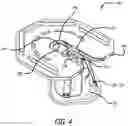Fig. 05 - Prosthetic heart valve packaging