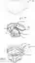 Fig. 07 - Prosthetic heart valve packaging