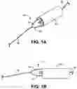 Fig. 02 - Temporary Vascular Valve and Related Systems and Methods