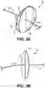 Fig. 06 - Temporary Vascular Valve and Related Systems and Methods