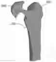 Fig. 01 - METHOD FOR ADJUSTING MECHANICAL PROPERTIES OF IMPLANT AND PATIENT SPECIFIC SURGICAL IMPLANTS