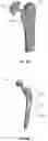 Fig. 09 - METHOD FOR ADJUSTING MECHANICAL PROPERTIES OF IMPLANT AND PATIENT SPECIFIC SURGICAL IMPLANTS