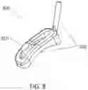 Fig. 09 - Hip Off-Loading Device and Method