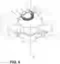 Fig. 06 - Interbody standalone intervertebral implant