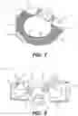 Fig. 07 - Interbody standalone intervertebral implant