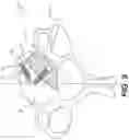 Fig. 08 - Interbody standalone intervertebral implant