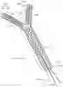 Fig. 01 - STENT